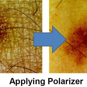 Applying Polarizer