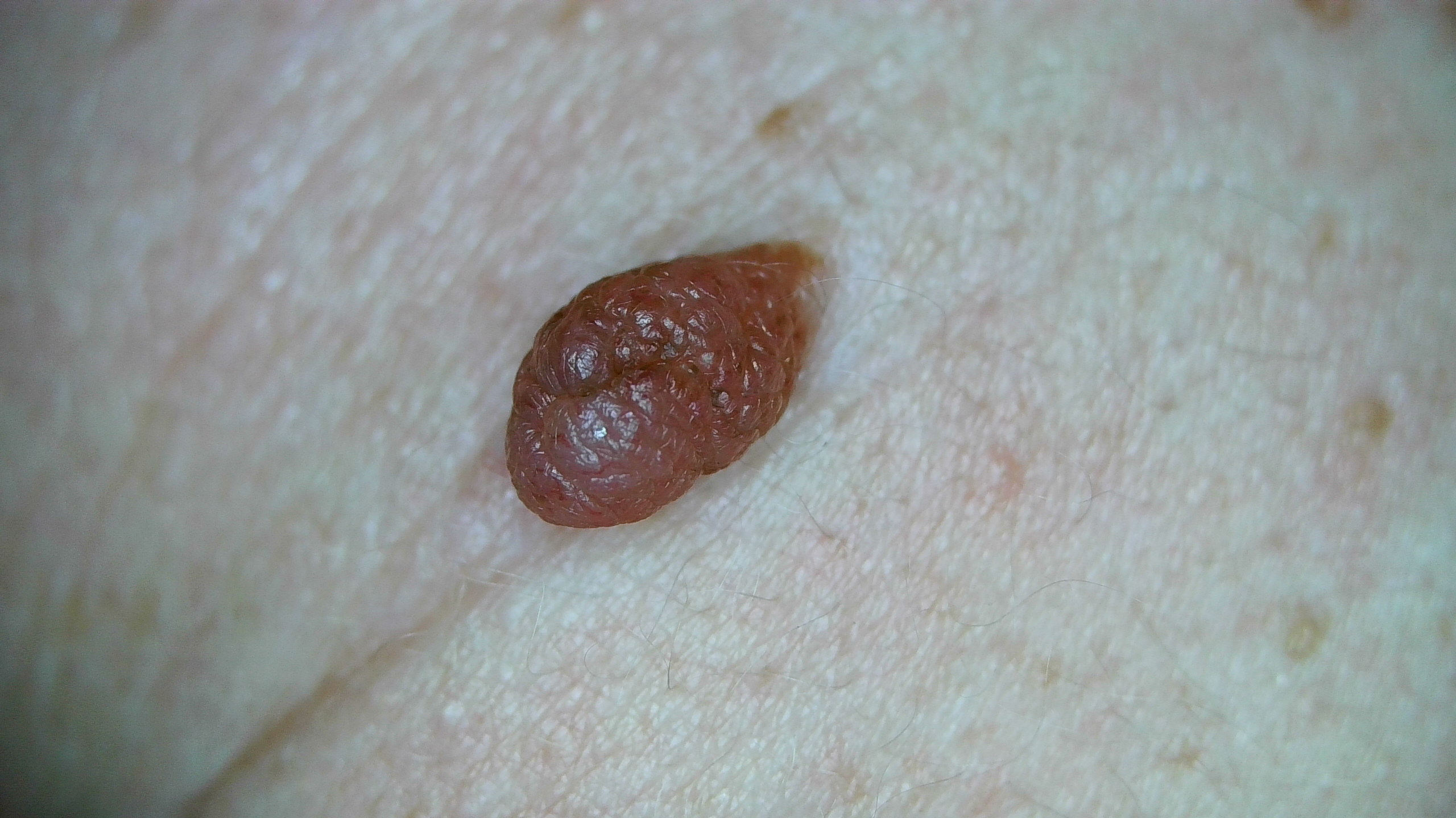 Firefly DE608 4K Caméra d'examen général pour la télésanté et la dermatologie